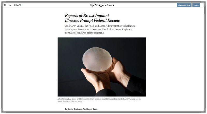 Breast Implant Illness, 가슴 보형물 병에 대해