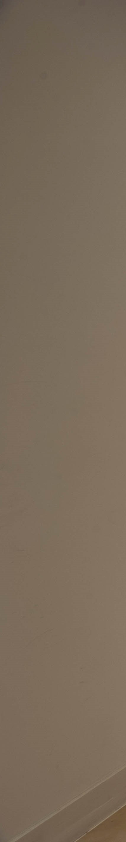여유증 수술 후 일상 복귀가 언제 가능할까? (출근, 운동) 사진 5