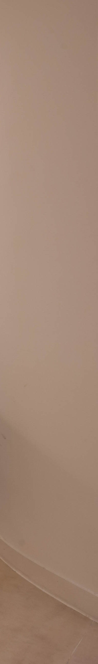 남자가슴 여유증? 여름휴가 동안 수술을 받기 위해 찾아온 40대 환자 사진 23