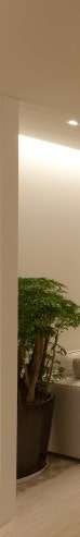 여유증 유선조직? 수술 후 가슴 모양을 생각한다면 중요합니다. 사진 14