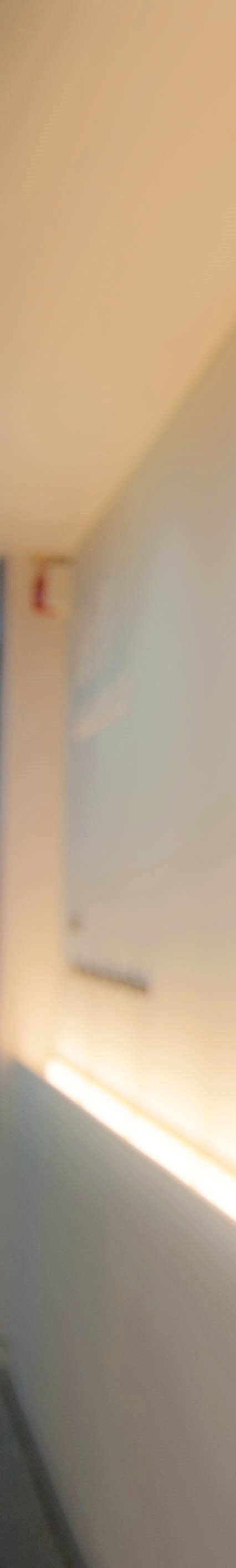 여유증 탈모의 관계? 환자들이 여유증 수술을 결심하는 이유 사진 4