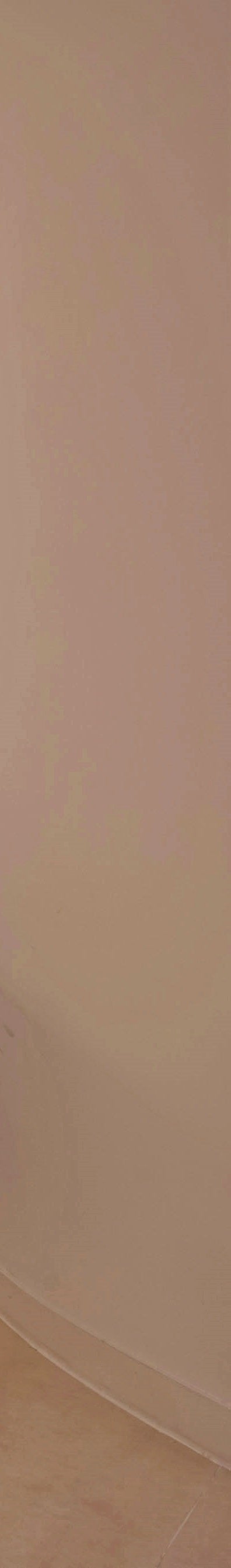 여유증수술통증이 걱정된다면 '이 글'을 참고하세요 사진 23