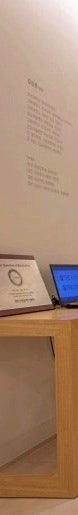 여유증 보정속옷 착용에 지쳐 찾아온 30대 환자의 사례 사진 25