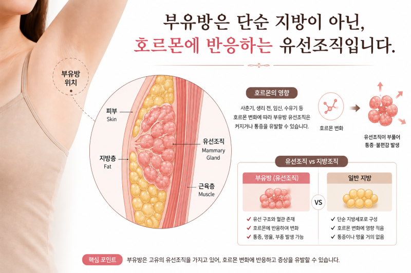 [부유방수술]"암은 아니라는데 괜찮은 건가요?" 부유방을 바라보는 시선의 차이에 대하여 사진 3